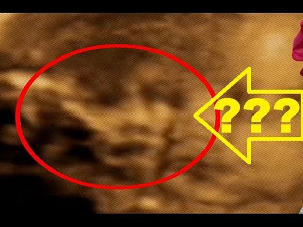 GRANDMA’S “GHOST” APPEARS IN BABY’S ULTRASOUND